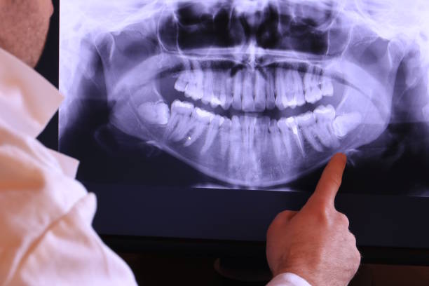 Best Orthodontic Emergency Dentist in Brook Park, OH