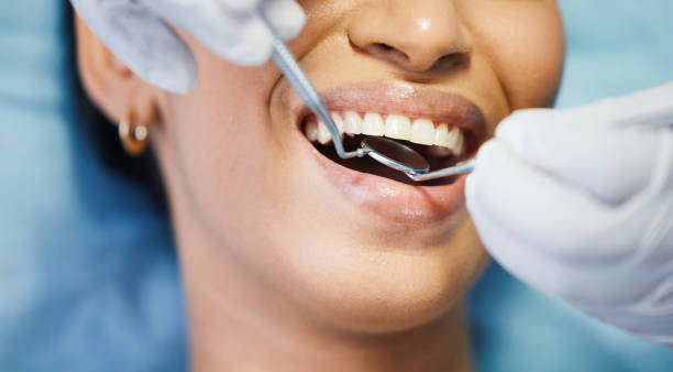 Best Emergency Dentist for Knocked-Out Tooth in Brook Park, OH