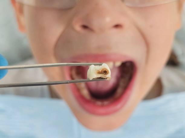 Best Pediatric Emergency Dentist in Brook Park, OH
